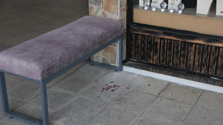 Antalyada kavga eden baba ile oğlu yaralandı