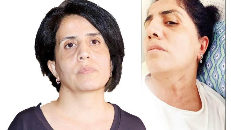 Sabiha’nın şiddet kabusu... Çocuğu olmuyor diye darp edildi