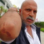 Dernek yöneticisine tekmeli tokatlı saldırı