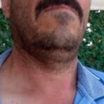 Ayının elinden dakika farkıyla kurtuldu, arı sokması sonucu hastanelik oldu