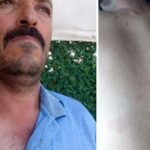 Duyduğu seslere giden çiftçi hayatının şokunu yaşadı Ayı saldırısından kurtuldum derken dehşeti yaşadı