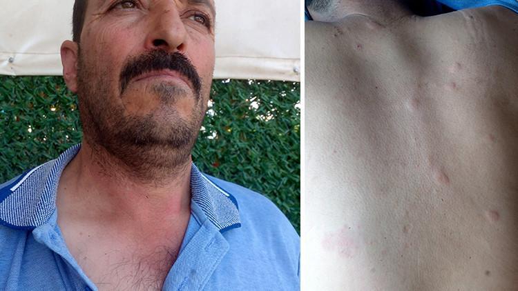 Duyduğu seslere giden çiftçi hayatının şokunu yaşadı Ayı saldırısından kurtuldum derken dehşeti yaşadı