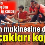 Kırım makinesine düştü bacakları koptu