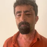 Antalya'da öfkeli damat kayınpederini hastanelik etti