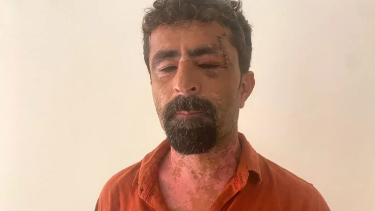 Antalya'da öfkeli damat kayınpederini hastanelik etti