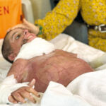 Küçük bedende büyük mucize