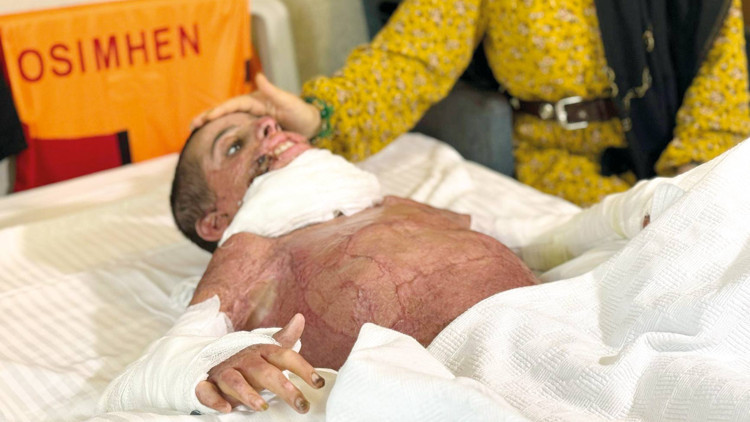 Küçük bedende büyük mucize