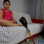 Protez bacağı dar gelen Özge için Türkiye ayağa kalktı