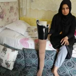 Depremden sağ çıktı, hayatta kalma mücadelesi devam ediyor