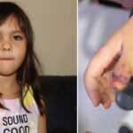 Antalyada anaokulunda korkunç olay 4 yaşındaki çocuğun parmağı, demir kapıya sıkışarak koptu