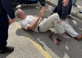 Rus çiftin kavgasında kan döküldü