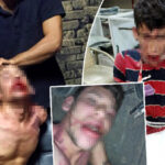 3 gün süren kâbus: Hamam böceği yedirildi, darbedildi, dişleri kırıldı İşkence davasında karar