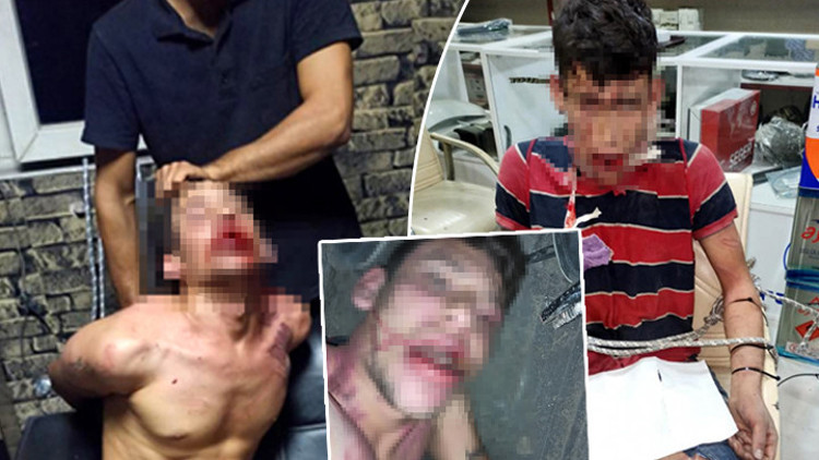 3 gün süren kâbus: Hamam böceği yedirildi, darbedildi, dişleri kırıldı İşkence davasında karar