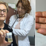 Antalyada ilginç olay Hapı alüminyum kabıyla yuttu, 4 yıl sonra akciğerinden bütün halinde çıkarıldı... Meğer hapı yutmuşum