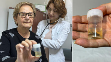 Antalyada ilginç olay Hapı alüminyum kabıyla yuttu, 4 yıl sonra akciğerinden bütün halinde çıkarıldı... Meğer hapı yutmuşum