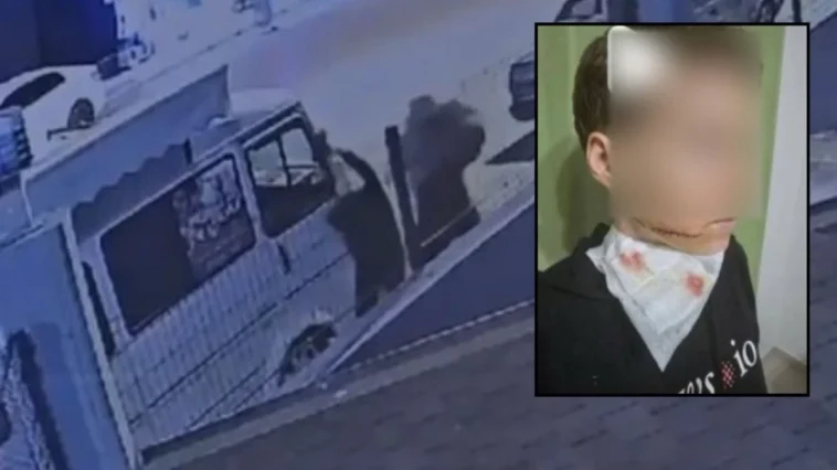 Alanya’da kadına saldıran şüpheli her yerde aranıyor