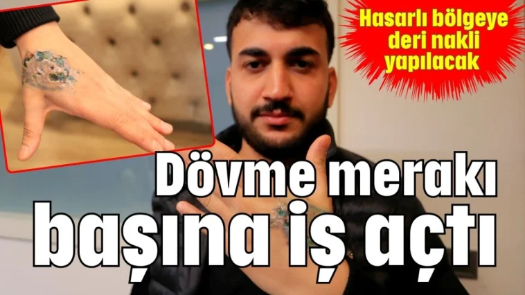 Dövme merakı başına iş açtı